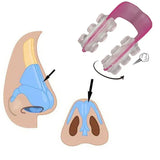 Nose Shaper Device (pair Of 2)